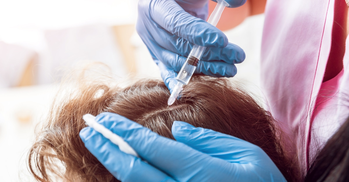 علاج الشعر بالخلايا الجذعية في السعودية
