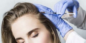 حقن البلازما لعلاج مشاكل الشعر PRP