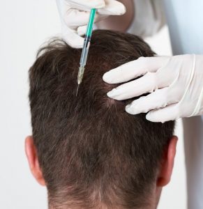 تكلفة علاج الشعر بالبلازما
