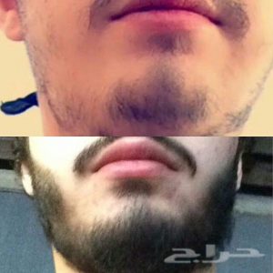 زيت الحشيش ينبت شعر الذقن